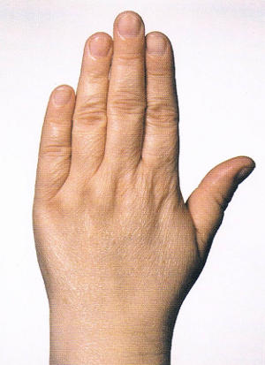 Handtyp Genießerhand