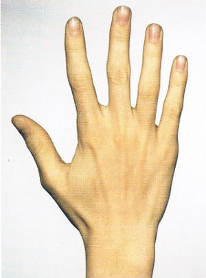 Handtyp gemischt, vielseitig