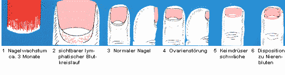 1 Nagelwachstum ca. 3 Monate - 2 Sichtbarer lymphatischer Blutkreislauf - 3 Normaler Nagel - 4 Ovarienstörung - 5 Keimdrüsenschwäche - 6 Disposition zu Nierenbluten