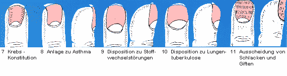 7 Krebskonstitution - 8 Anlage zu Asthma - 9 Disposition zu Stoffwechselstörungen - 10 Disposition zu Lungentuberkulose - 11 Ausscheidung von Schlacken und Giften