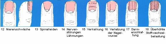 12 Nierenschwäche - 13 Spinalleiden - 14 Nervenstörungen, Lähmungen - 15 Verkalkung - 16 Verletzung der Nagelwurzel - 17 Darmerschlaffung - 18 Überhöhte Soffwechselbelastung