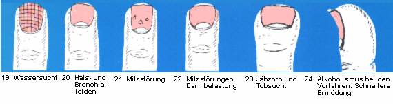 19 Wassersucht - 20 Hals- und Bronchialleiden - 21 Milzstörung - 22 Milzstörungen, Darmbelastung - 23 Jähzorn und Tobsucht - 24 Alkoholisums bei den Vorfahren. Schnellere Ermüdung