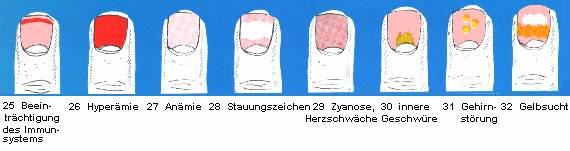 25 Beeinträchtigung des Immunsystems - 26 Hyperämie - 27 Anämie - 28 Stauungszeichen - 29 Zyanose, Herzschwäche - 30 Innere Geschwüre - 31 Gehirnstörung - 32 Gelbsucht